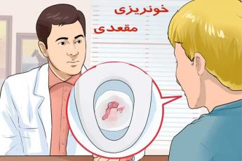 خونریزی مقعد چه علائمی دارد؟ انواع خونریزی و نحوه تشخیص و درمان آن