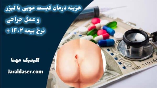 عکس هزینه درمان کیست مویی با لیزر و عمل جراحی در کلینیک مهنا