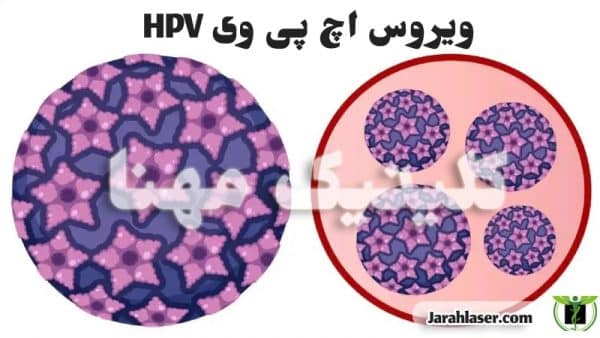 علائم ویروس hpv چیست