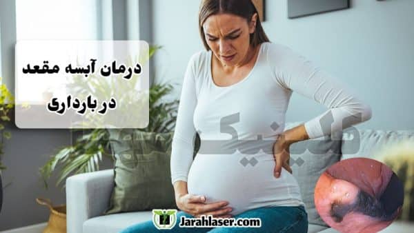 درمان آبسه مقعد در بارداری