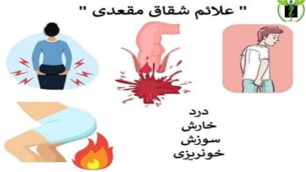 نشانه های زخم شدن مقعد همراه با خونریزی