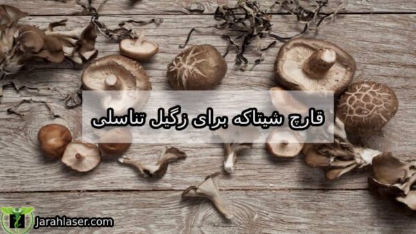 قارچ شیتاکه برای زگیل تناسلی