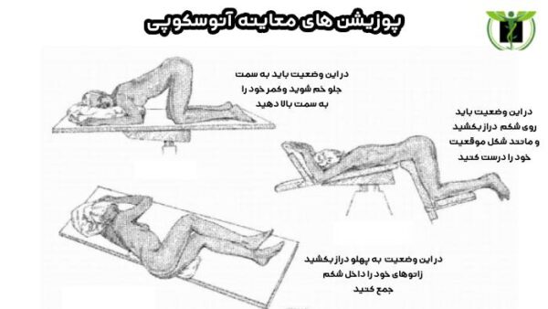 پوزیشن های معاینه آنوسکوپی