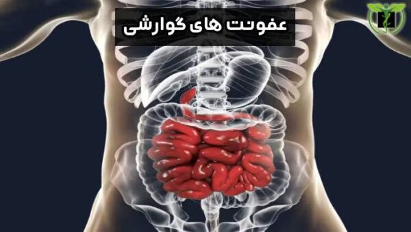 عفونت های گوارشی ازدیگر دلایل ترشحات مقعدی