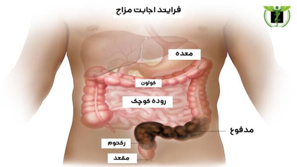 فرایند اجابت مزاج